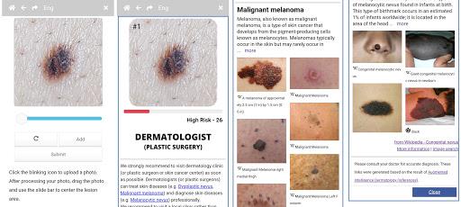 Model Dermatol – Skin Disease - Image screenshot of android app
