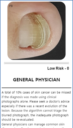 Model Dermatol – Skin Disease - Image screenshot of android app