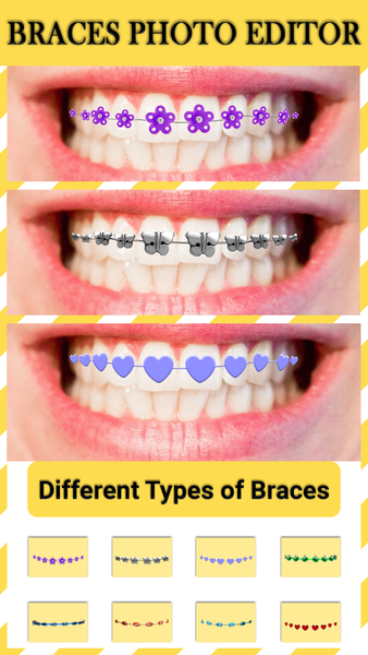 Braces : Add Braces On Photo - Image screenshot of android app