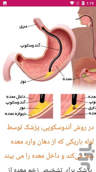 راهنما علل درمان زخم معده - Image screenshot of android app