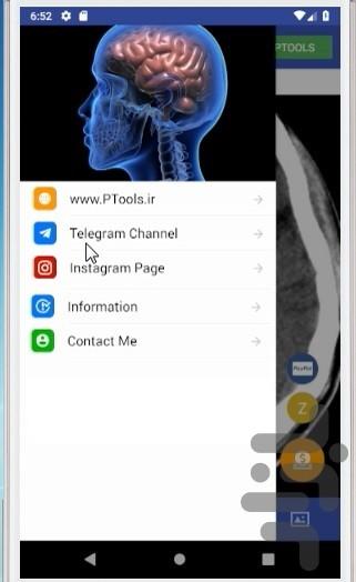 NeuroImaging - Image screenshot of android app