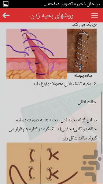 آموزش انواع سوچور ( بخیه ) - Image screenshot of android app