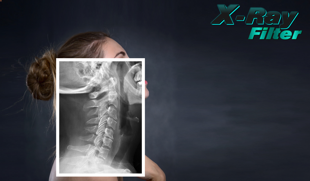 دانلود برنامه X-ray filter for photos اندروید | بازار