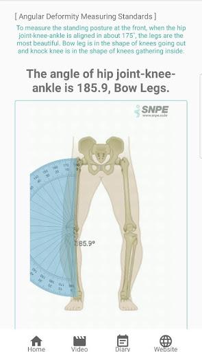 SNPE(Self Natural Posture Excercise) App - عکس برنامه موبایلی اندروید