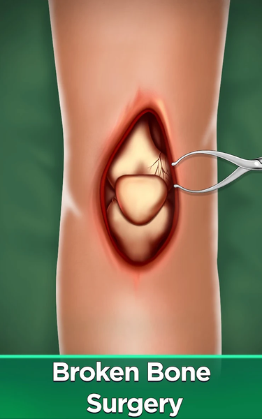 Surgery Simulator Doctor Games - Gameplay image of android game