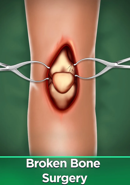 Surgery Simulator Doctor Games - Gameplay image of android game