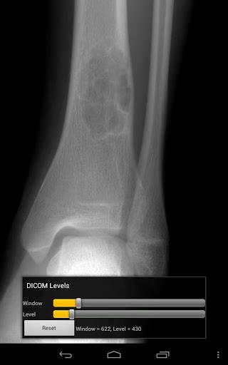 Fast Image Viewer Free - عکس برنامه موبایلی اندروید