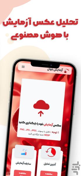 گلبول | خواندن جواب آزمایش با دوربین - Image screenshot of android app