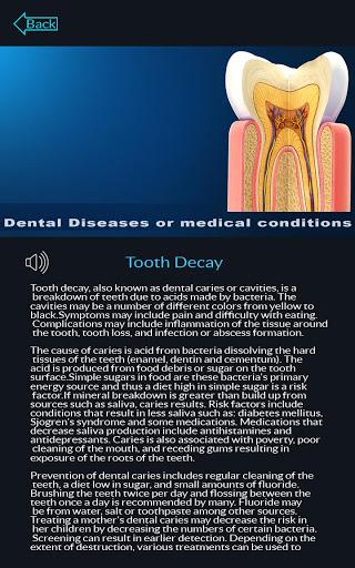 Dental Anatomy - Image screenshot of android app