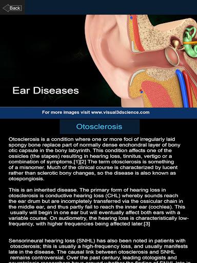 My Ear Anatomy - عکس برنامه موبایلی اندروید