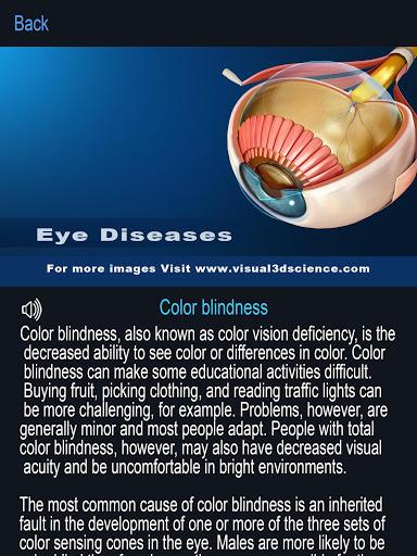 My Eye Anatomy - عکس برنامه موبایلی اندروید