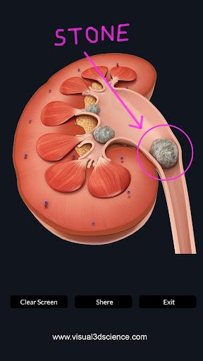 Kidney Anatomy - عکس برنامه موبایلی اندروید