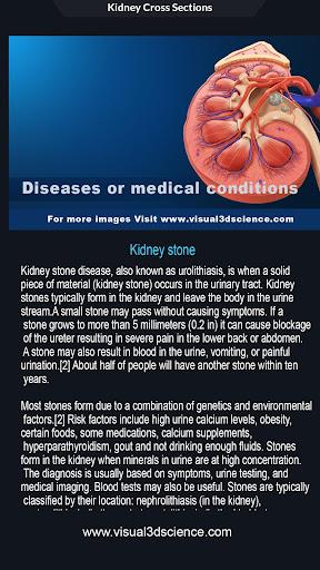 Kidney Anatomy - عکس برنامه موبایلی اندروید