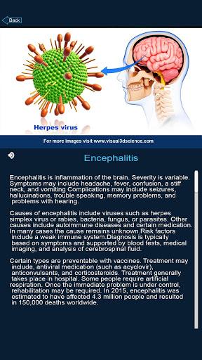 Brain Anatomy Pro. - Image screenshot of android app