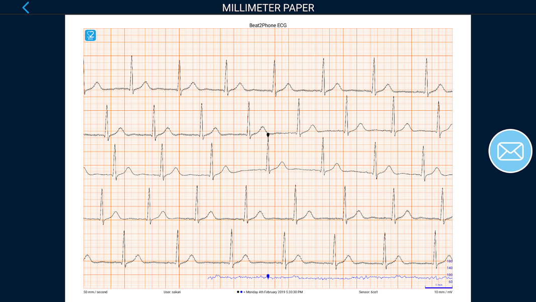 Beat۲Phone ECG - عکس برنامه موبایلی اندروید