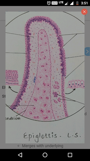 HistoGrams⁺ - Image screenshot of android app