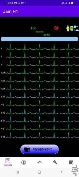 تحلیلگر سیگنال قلب جم اچ 1 - عکس برنامه موبایلی اندروید