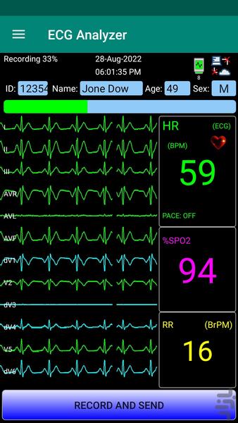 تحلیلگر سیگنال قلب - جم اس ۳ - عکس برنامه موبایلی اندروید