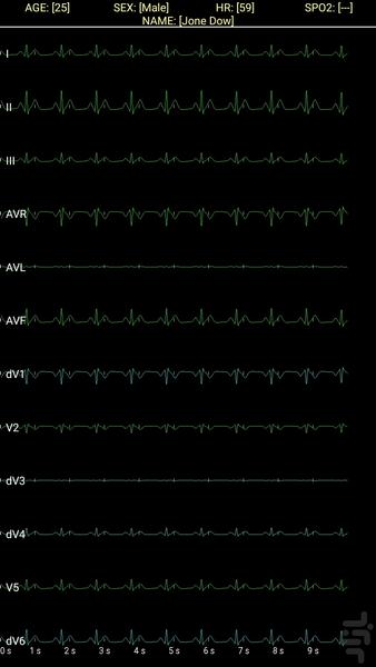 تحلیلگر سیگنال قلب - جم اس ۳ - عکس برنامه موبایلی اندروید