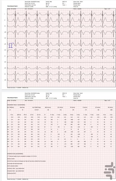 تحلیلگر سیگنال قلب - جم اس ۳ - عکس برنامه موبایلی اندروید