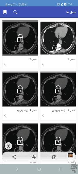 سی تی اسکن قفسه سینه به زبان ساده - عکس برنامه موبایلی اندروید