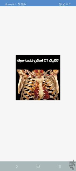 سی تی اسکن قفسه سینه به زبان ساده - عکس برنامه موبایلی اندروید
