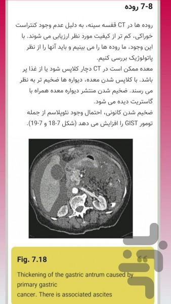 سی تی اسکن قفسه سینه به زبان ساده - عکس برنامه موبایلی اندروید