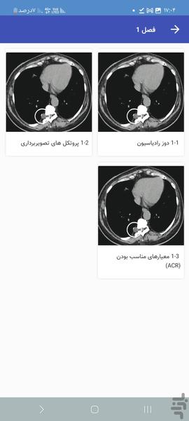 سی تی اسکن قفسه سینه به زبان ساده - عکس برنامه موبایلی اندروید