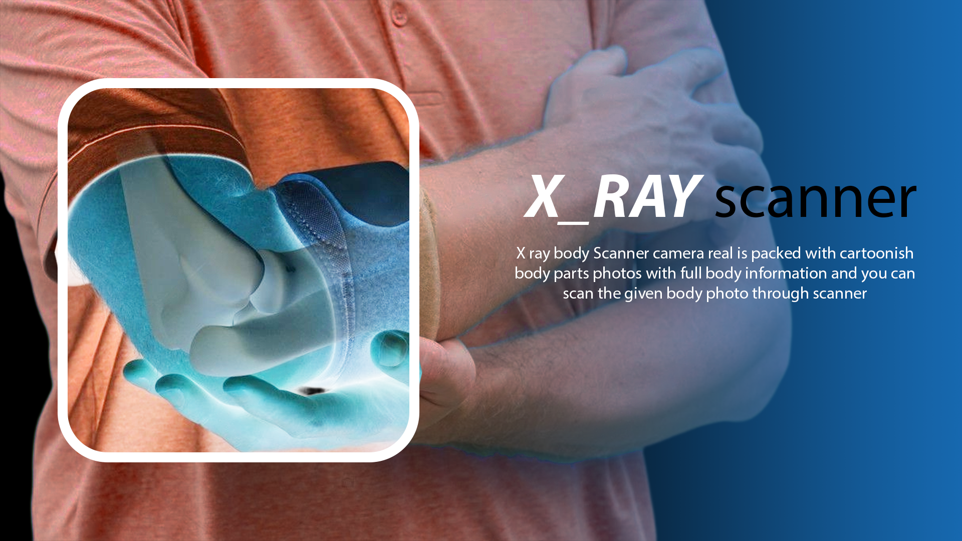 x ray body scanner