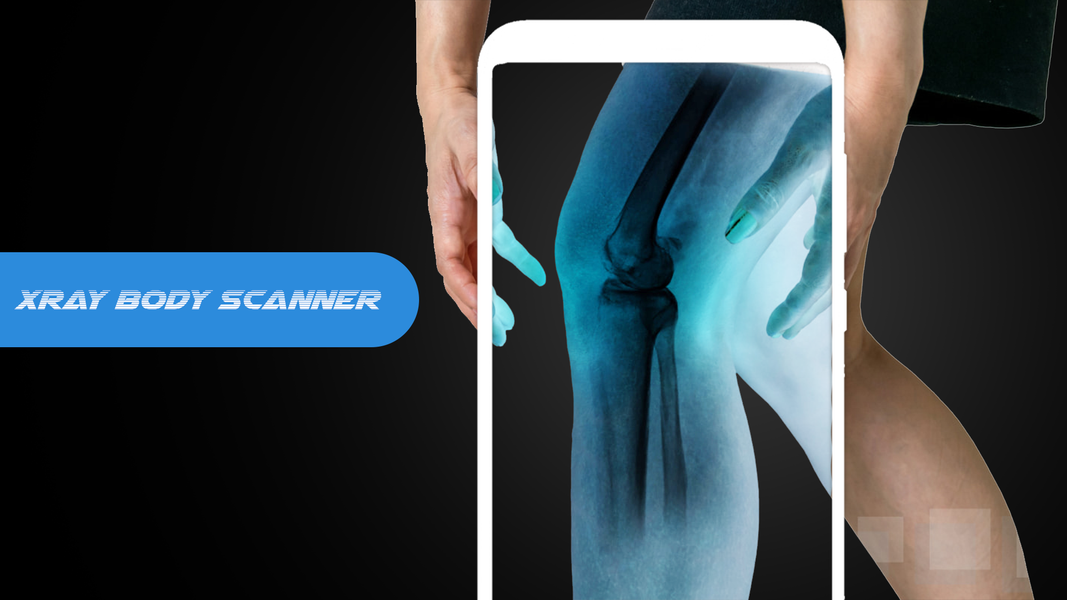 X ray Body Scanner Xray camera - Gameplay image of android game