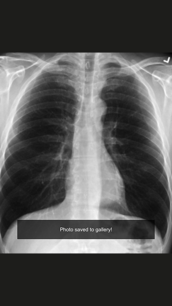 Xray scan filter camera - عکس برنامه موبایلی اندروید