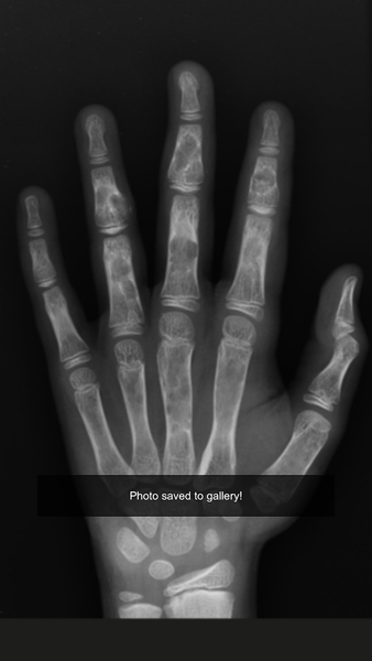 Xray scan filter camera - عکس برنامه موبایلی اندروید