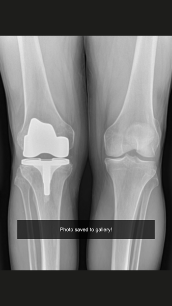 Xray scan filter camera - عکس برنامه موبایلی اندروید