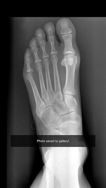 Xray scan filter camera - عکس برنامه موبایلی اندروید