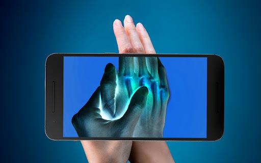XRAY Scanner X-ray Doctor Game - Gameplay image of android game