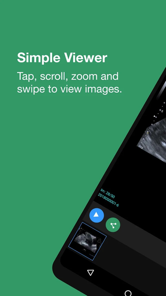 IA X-rays - Image screenshot of android app