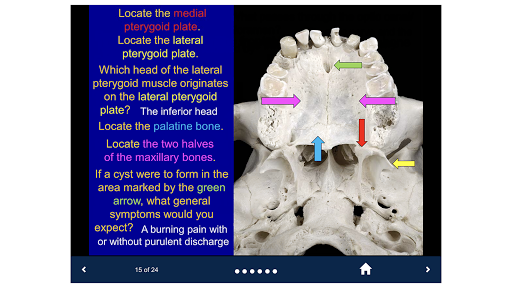 Head & Neck Anatomy-SecondLook - Image screenshot of android app
