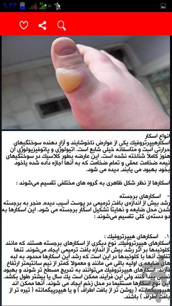 انواع سوختگی و درمان آنها - عکس برنامه موبایلی اندروید