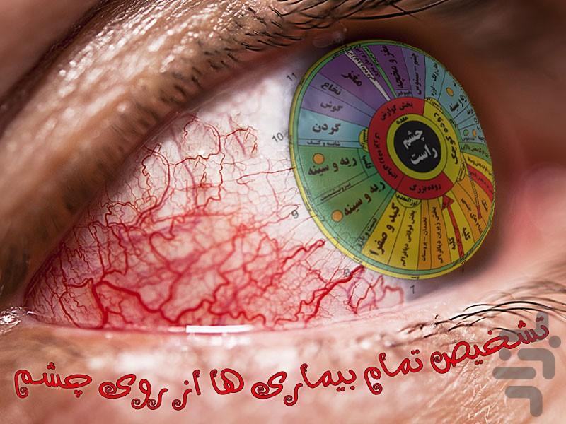 علم تشخیص بیماری از روی چشم - عکس برنامه موبایلی اندروید