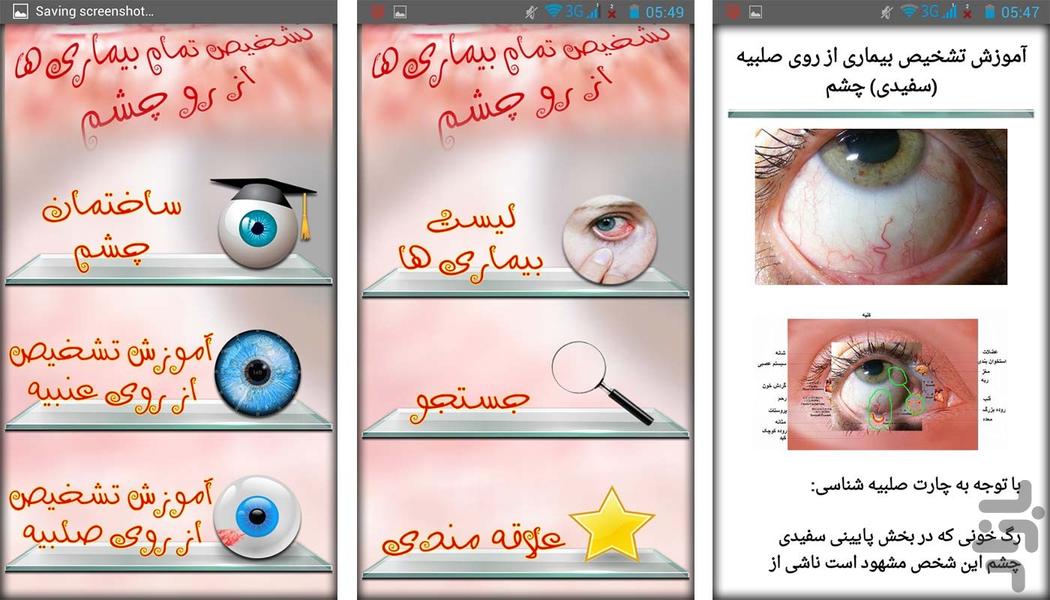 علم تشخیص بیماری از روی چشم - عکس برنامه موبایلی اندروید