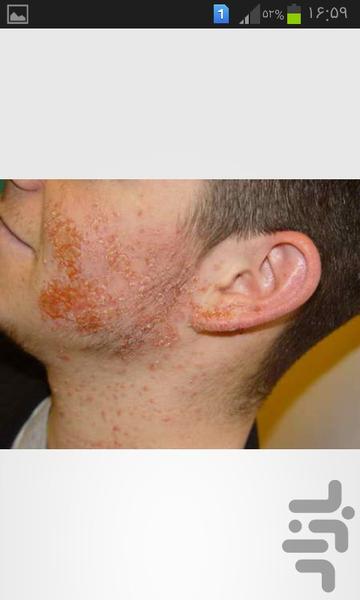 بیماریهای شایع پوست و مو - عکس برنامه موبایلی اندروید