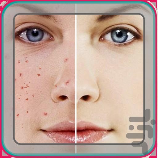 Acne treatment - Image screenshot of android app