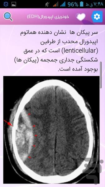 تفسير Brain CT - عکس برنامه موبایلی اندروید