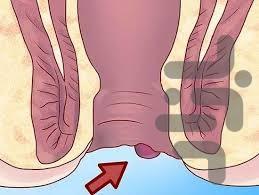 کلینیک درمان همورویید - عکس برنامه موبایلی اندروید