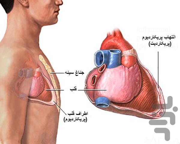 درمان مشکلات قلبی - عکس برنامه موبایلی اندروید