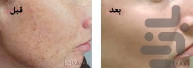 قهوه درمانی - عکس برنامه موبایلی اندروید