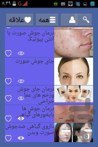 درمان فوری جوش صورت - Image screenshot of android app