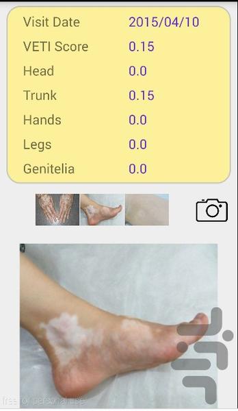 VETI Score - Image screenshot of android app