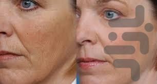 پوست جوان با داروی گیاهی - عکس برنامه موبایلی اندروید