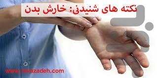 خارش پوست رو از بین ببر - Image screenshot of android app